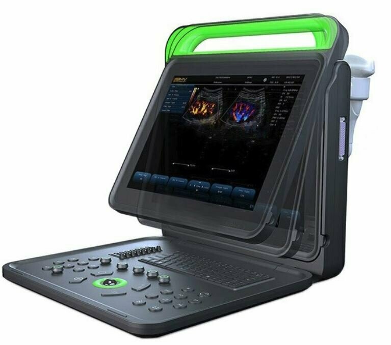 BPU60V Hand-Carried 15" Color Doppler Ultrasound System