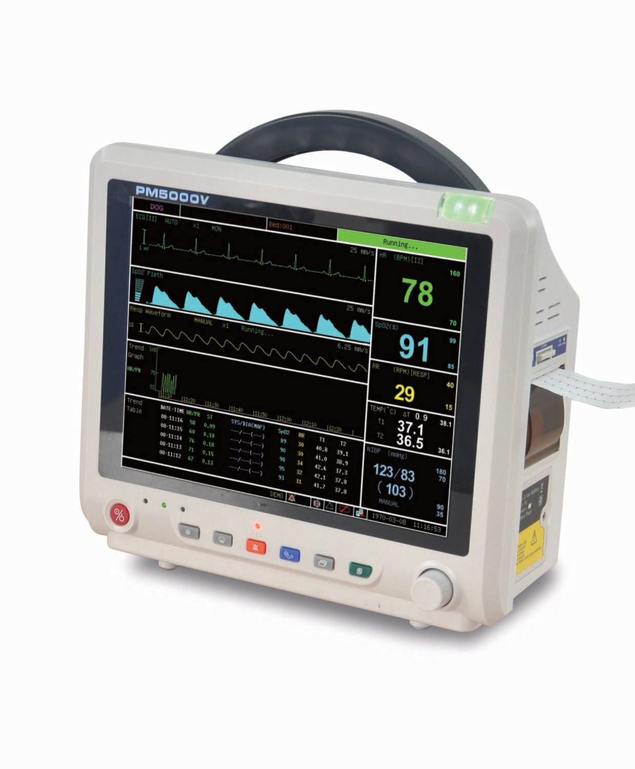 PM5000VCSP 12" Veterinary Multi-parameter Monitor with ECG RESP SpO2 NIBP TEMP PR ETCO2 (Sidestream) Printer