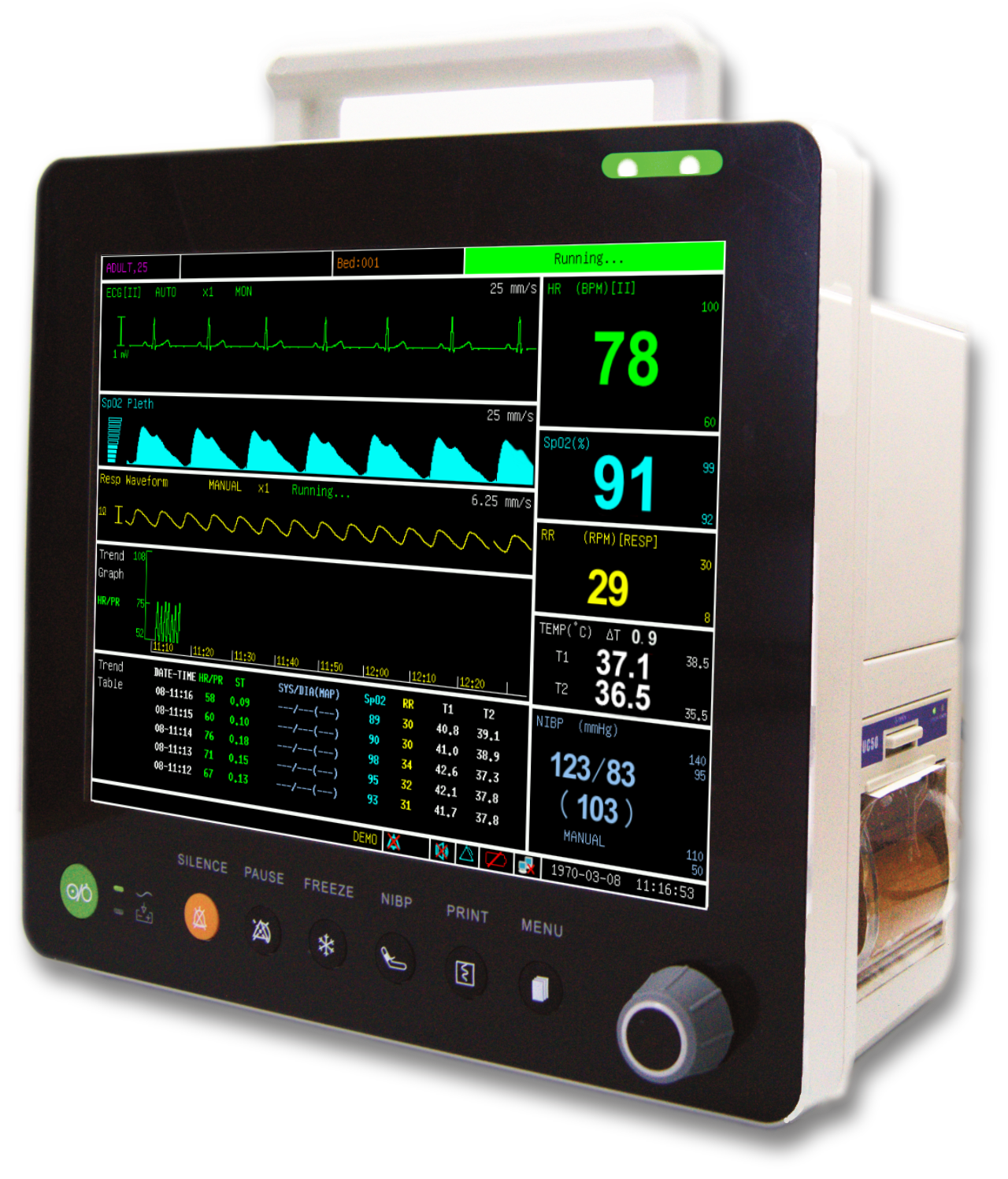 PM6000CM 12" Multi-parameters Monitor with ECG RESP SpO2 NIBP TEMP PR ETCO2(mainstream)