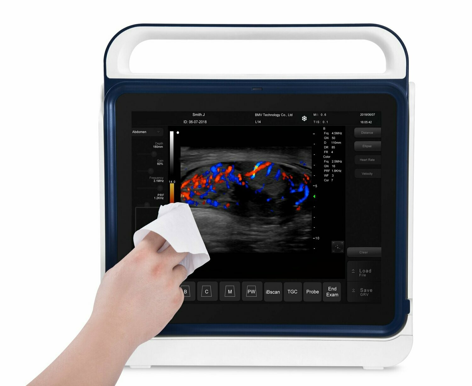 PT60V Veterinary 15" Touchscreen Color Doppler Ultrasound Machine
