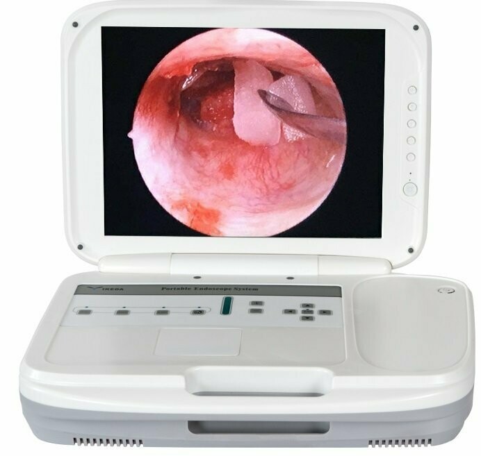 YKD - 9003 Laptop HD Endoscope