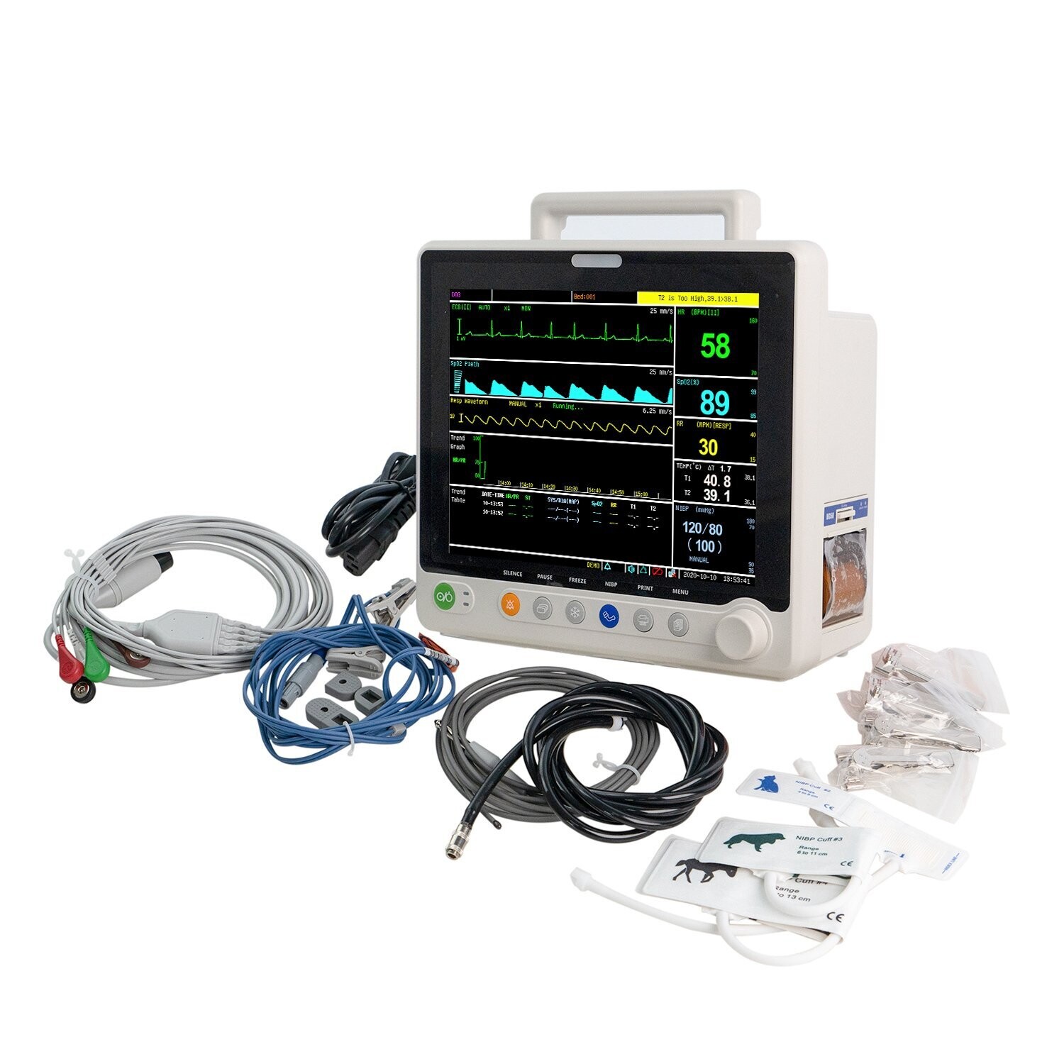 UTM02V Veterinary 12" Multi-parameters Monitor - ECG RESP SpO2 NIBP TEMP PR