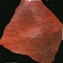 Sonnenstein