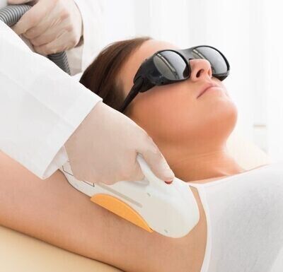 LADIES - Sideburns - IPL (6 visits)