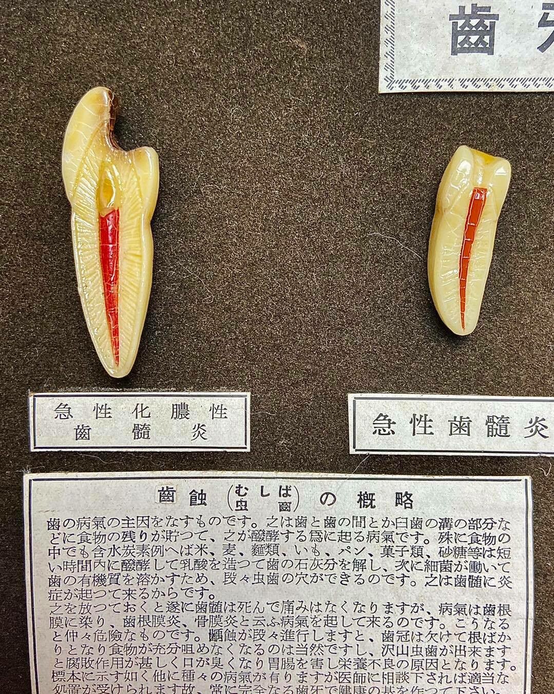 Medical display: wax models of dental diseases