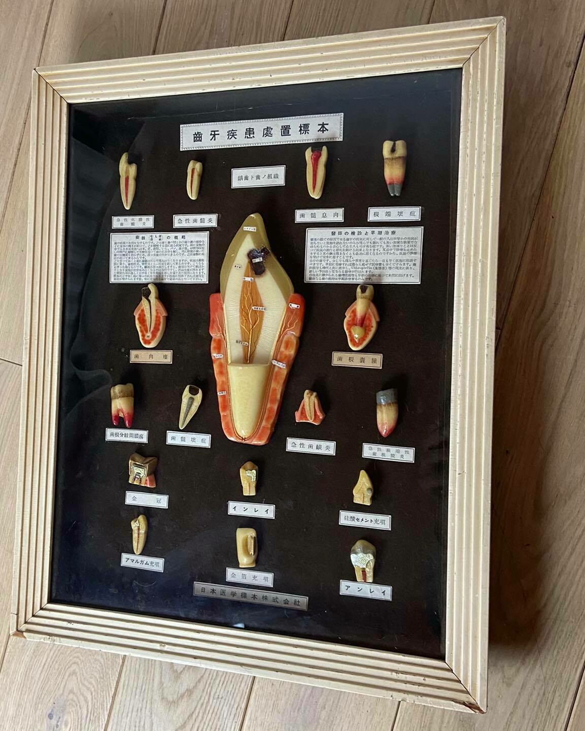 Medical display: wax models of dental diseases