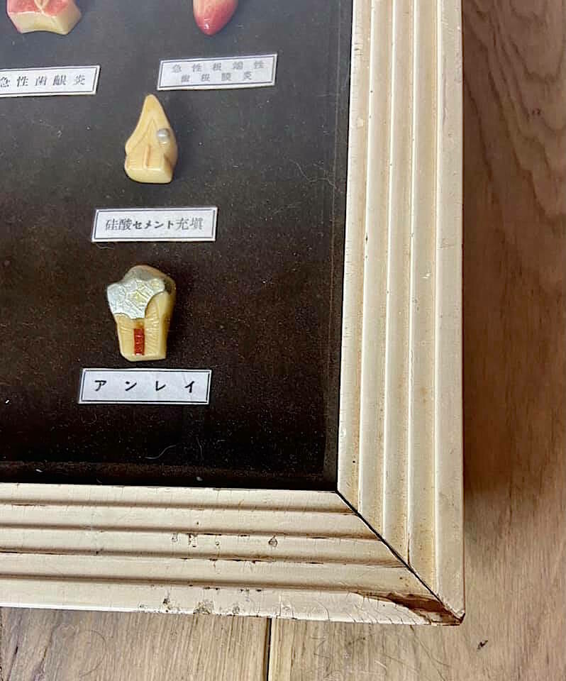 Medical display: wax models of dental diseases
