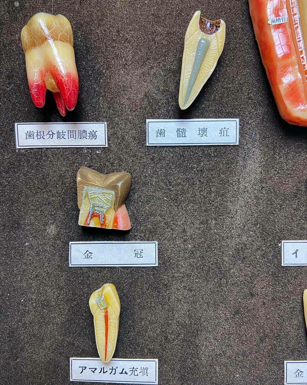 Medical display: wax models of dental diseases