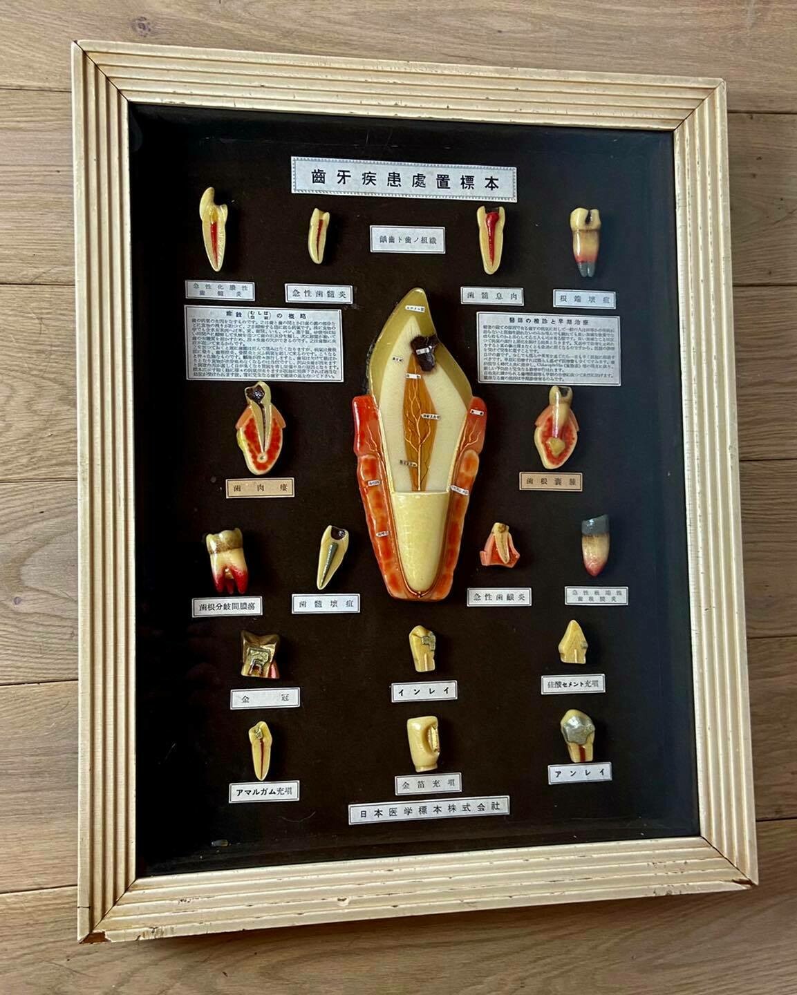 Medical display: wax models of dental diseases