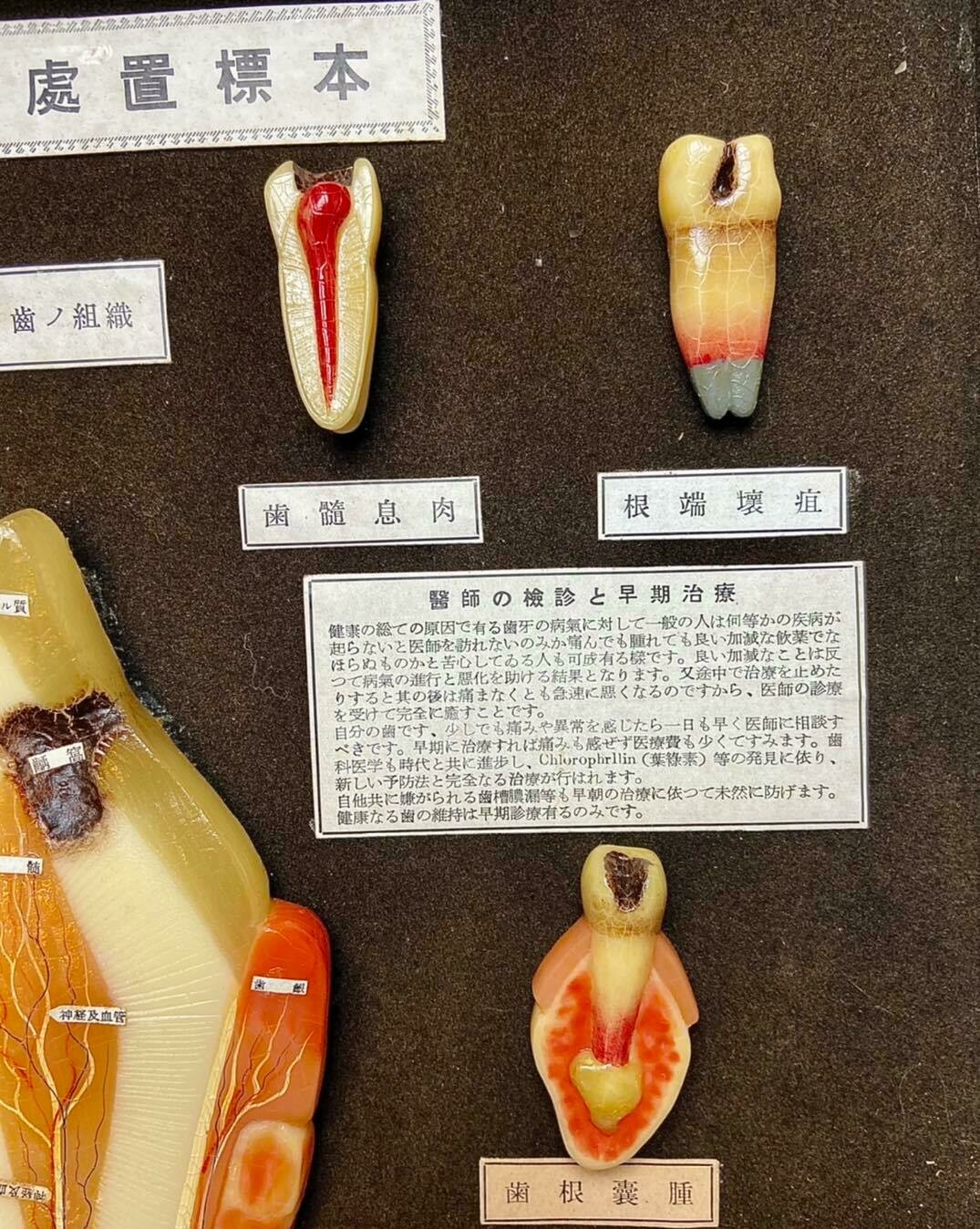 Medical display: wax models of dental diseases