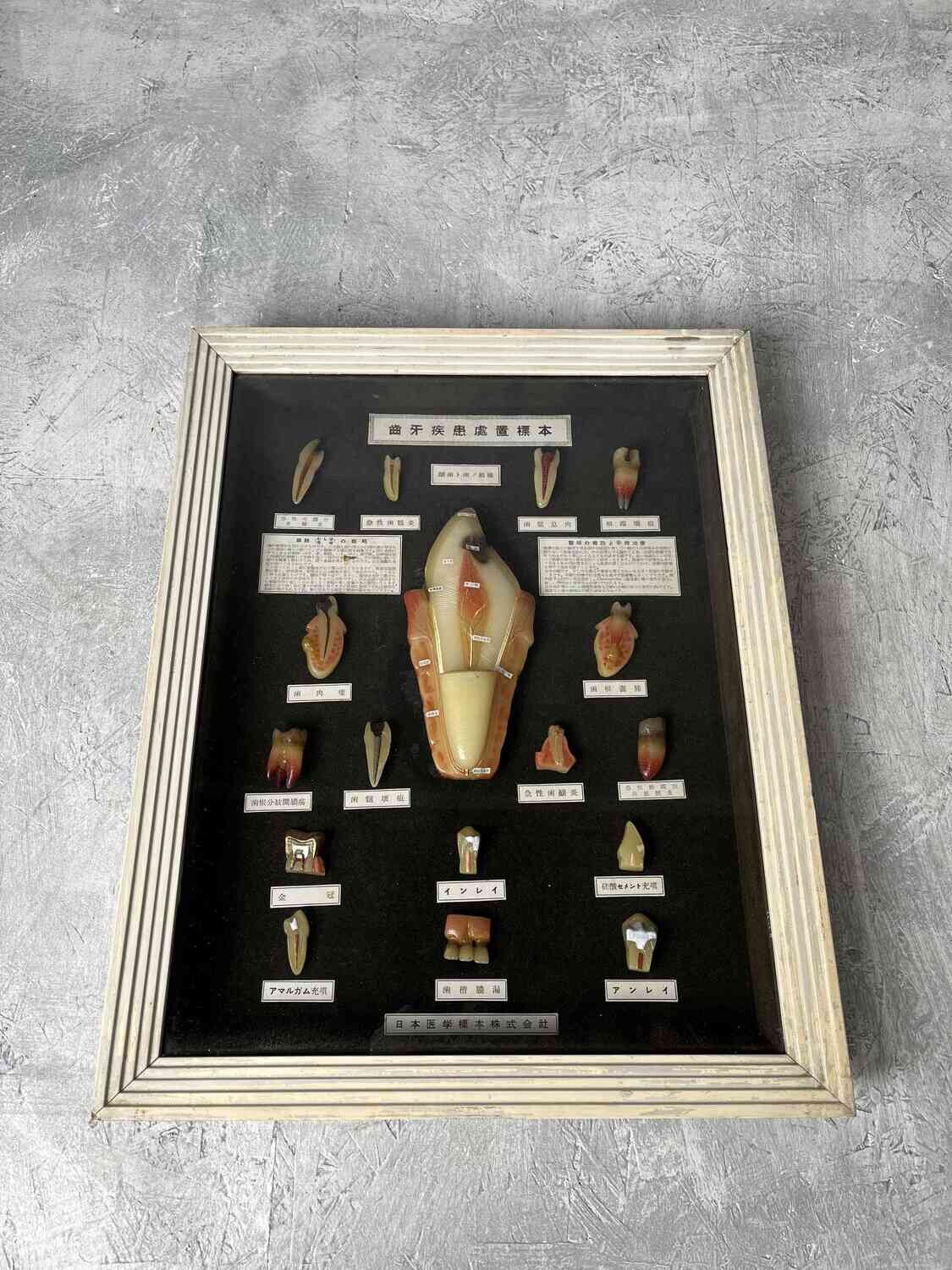 Medical display: wax models of dental diseases