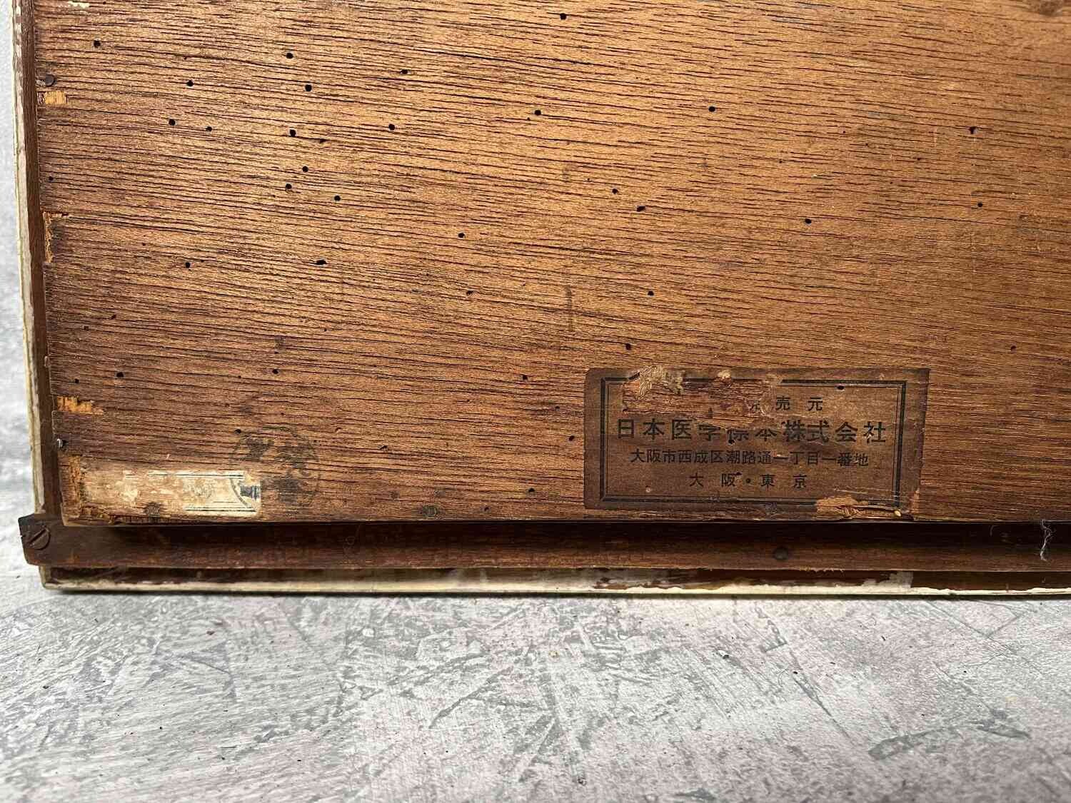 Medical display: wax models of dental diseases