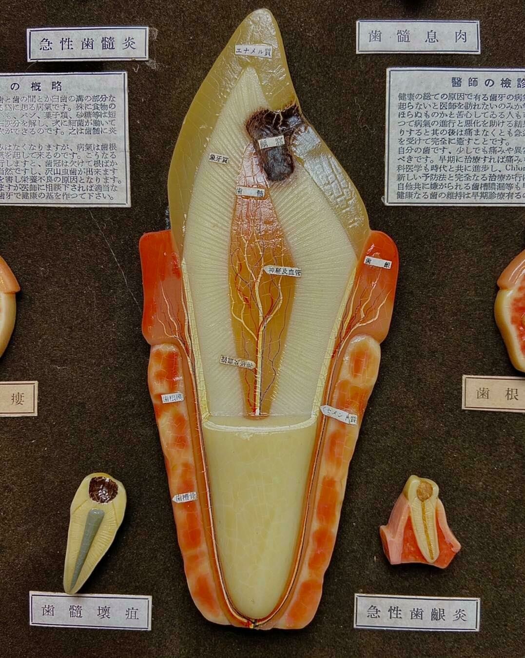 Japanese Dental Teaching Display with Anatomical Models, ca. 1920–1930