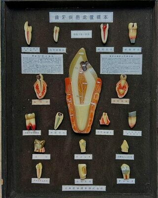 Japans Tandheelkundig display met Anatomische Modellen, ca. 1920–1930