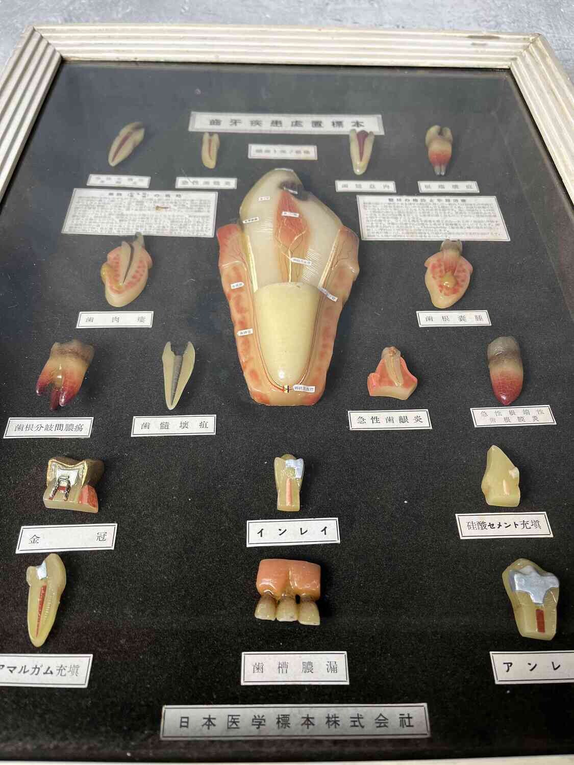 Japanese Dental Teaching Display with Anatomical Models, ca. 1920–1930