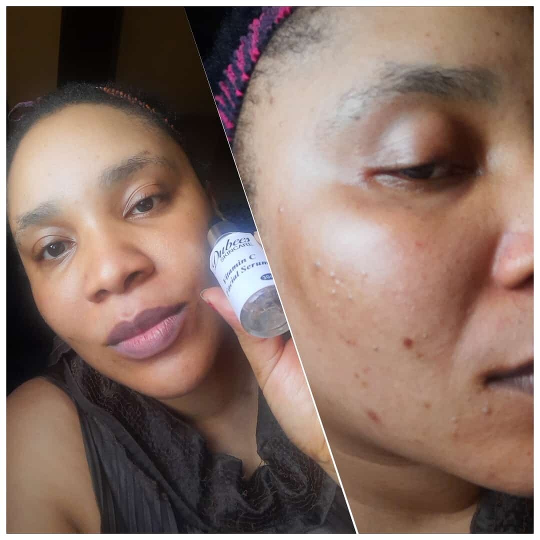 Dubees Skin Care Vitamin C Serum