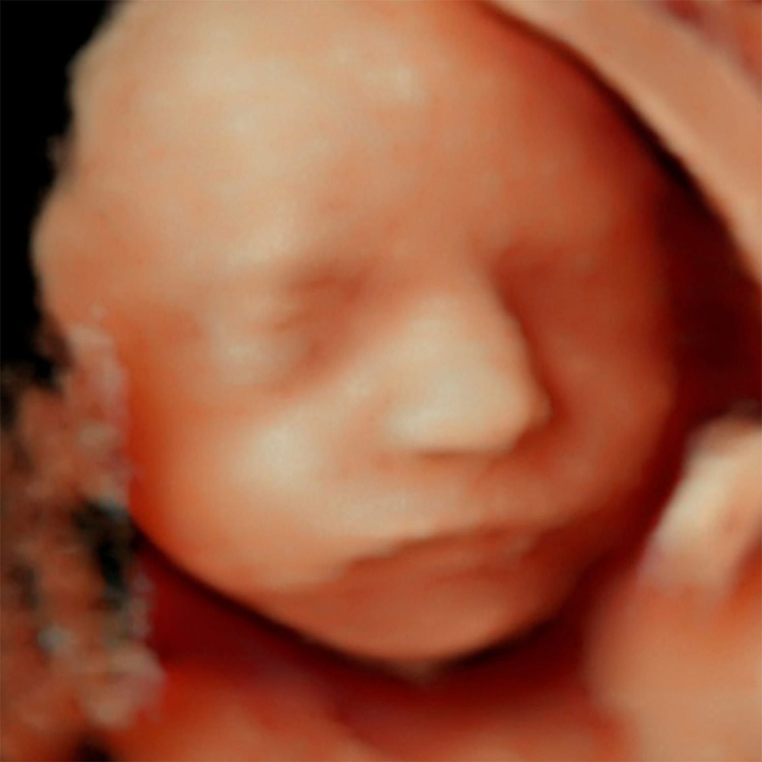 PACK CRECIMIENTO 6 ECOS 5D