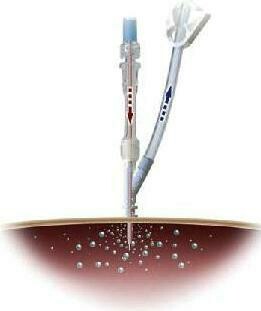 DLP™ Dual Lumen Aortic Root Cannulae with Vent Line