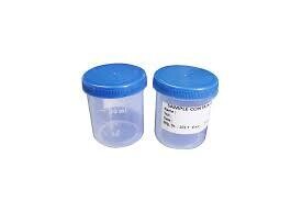 Urine Container-30 ml