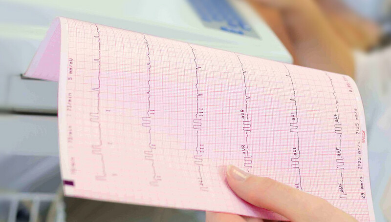 ECG PAPER FOR MINDRAY