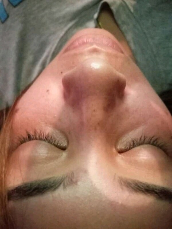limpiezas facial ultrasónicas con alta frecuencia
