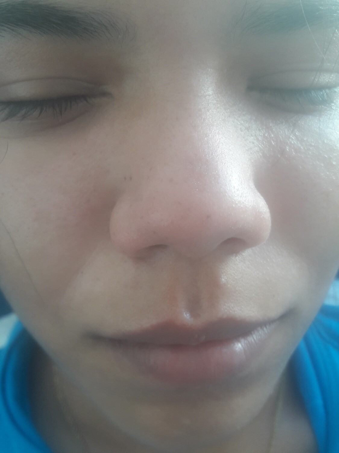 Depilacion de bozo y cejas