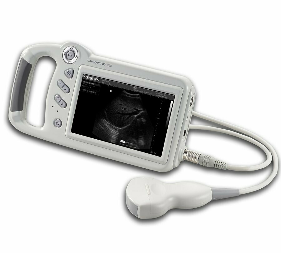 Handheld Portable Ultrasound Scanner