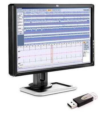 Holter ECG Workstation 99.9% Accuracy Holter ECG Analysis Software System
