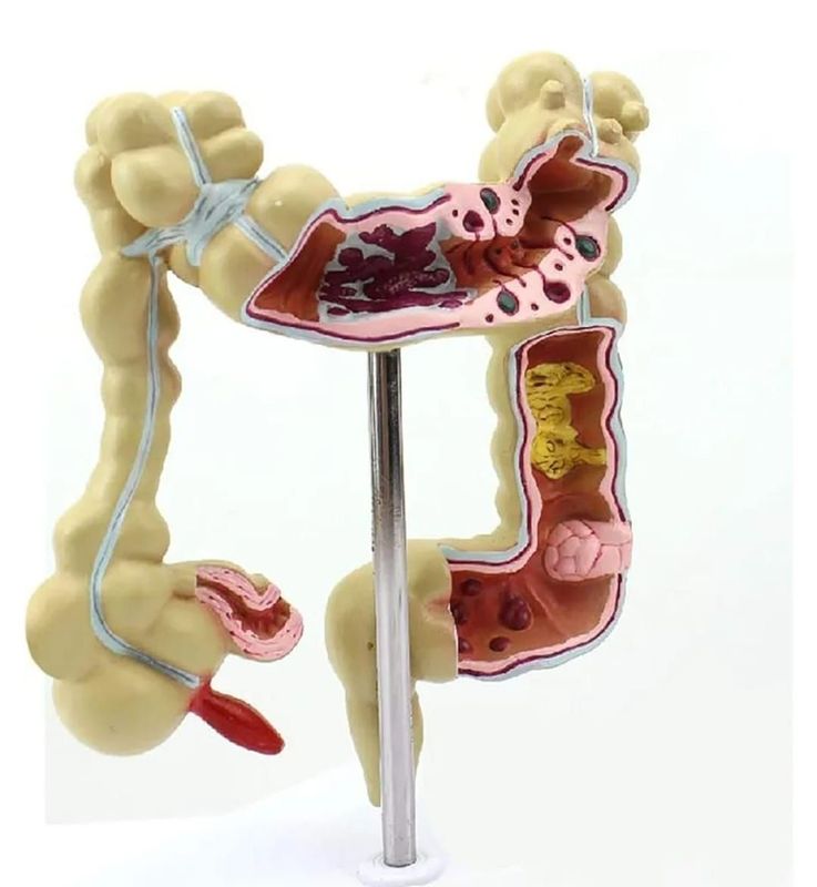 Human Intestine Colon