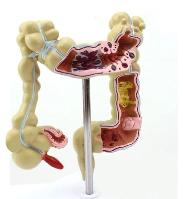 Human Intestine Colon