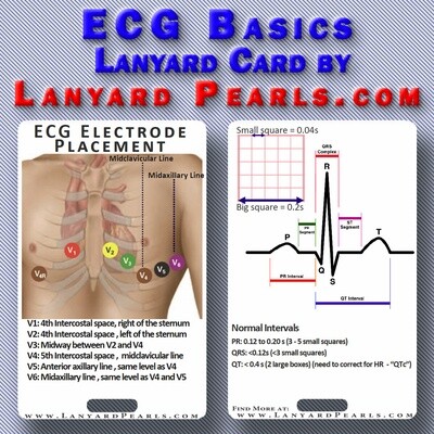 ECG Basics