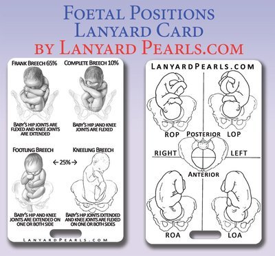 Foetal Positions