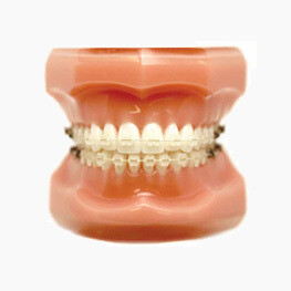 Sistemas de ortodoncia FLI