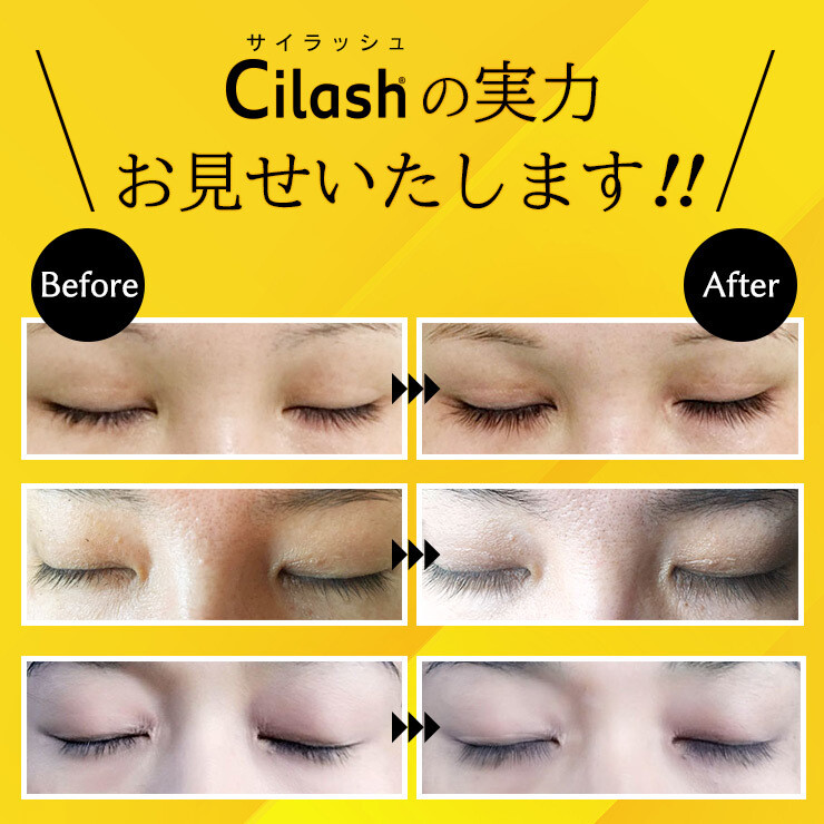 まつ毛美容液Cilash 3ヶ月分です。 サイラッシュ まつ毛美容液3ml （まつげ​ まつ毛 睫毛 まつ育 マツ育