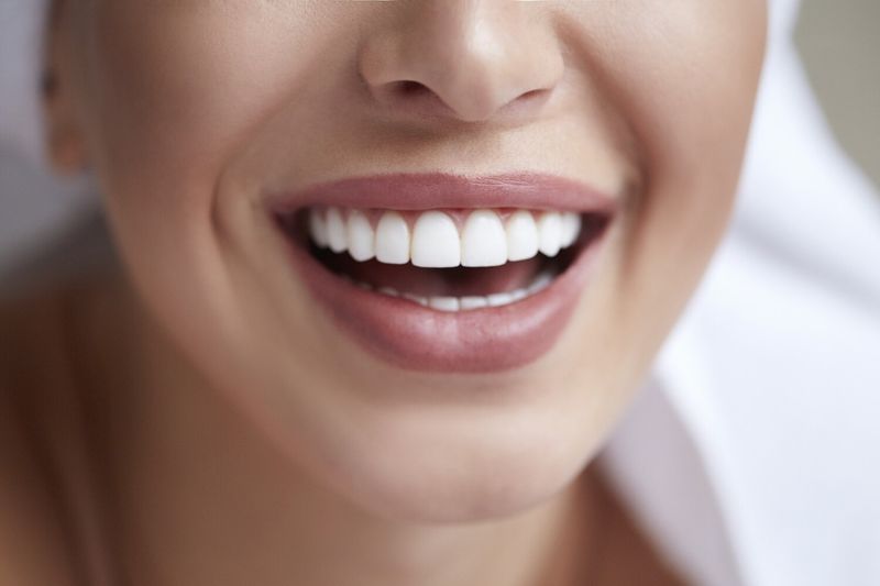 LED tooth whitening session 40 min