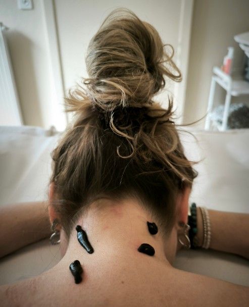 Séance découverte de l'hirudothérapie