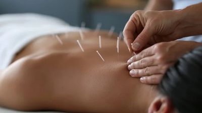 Séance d'Acunpuncture 75min