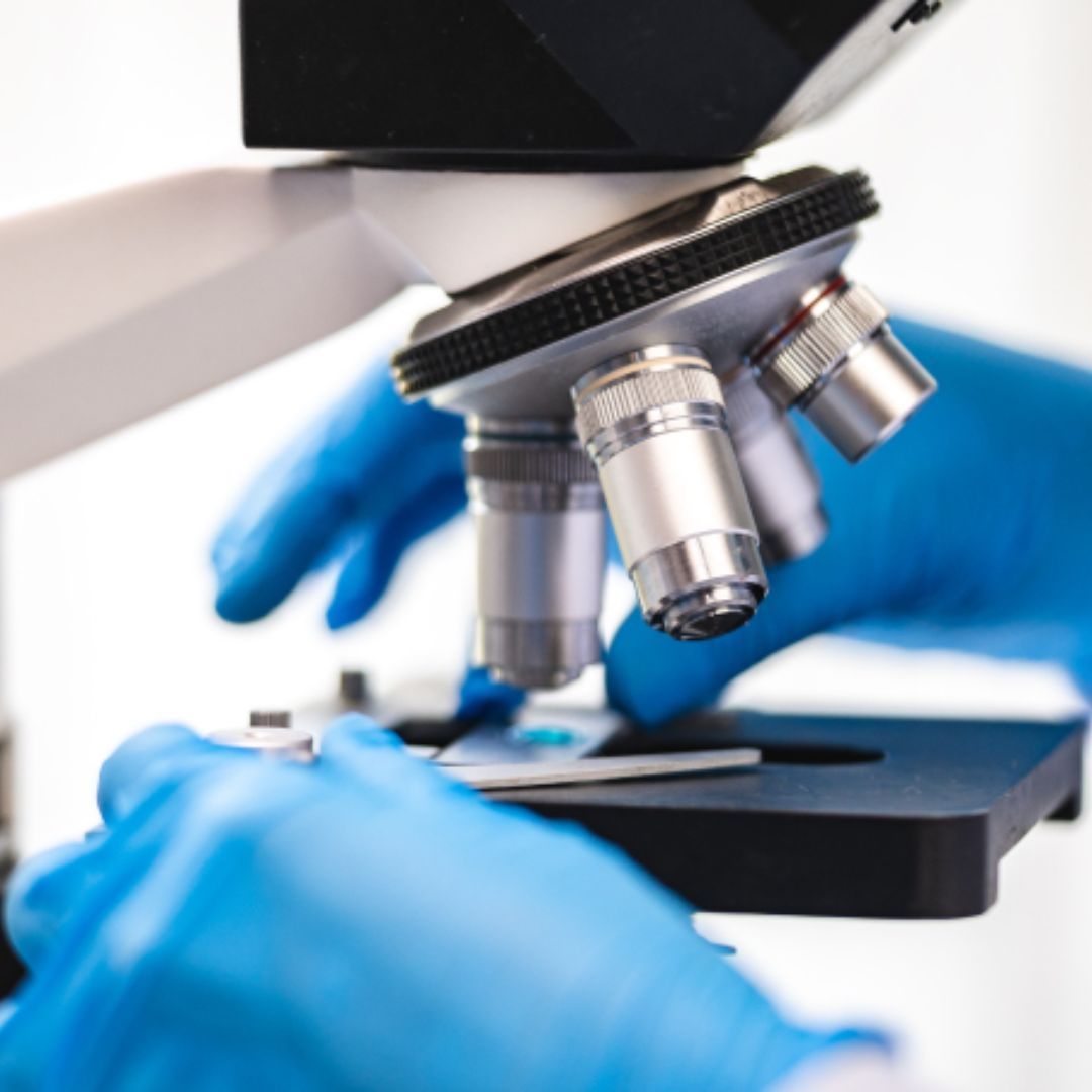 ESTUDIO INMUNOHISTOQUÍMICO