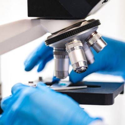 ESTUDIO INMUNOHISTOQUÍMICO