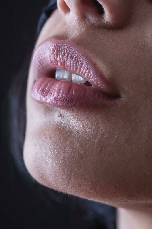 Upper Lip Waxing