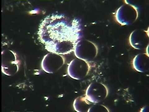 Dark field microscopy