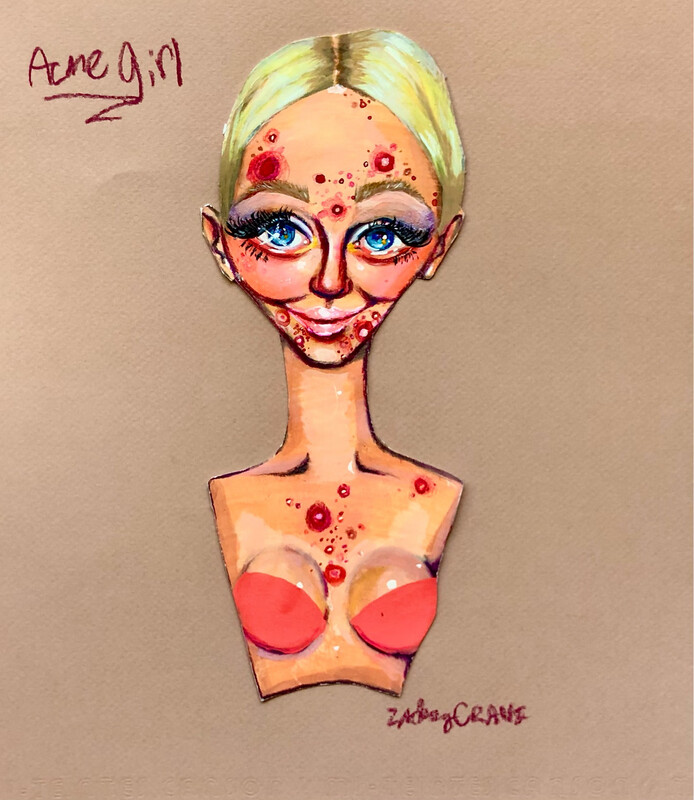 Acne Girl