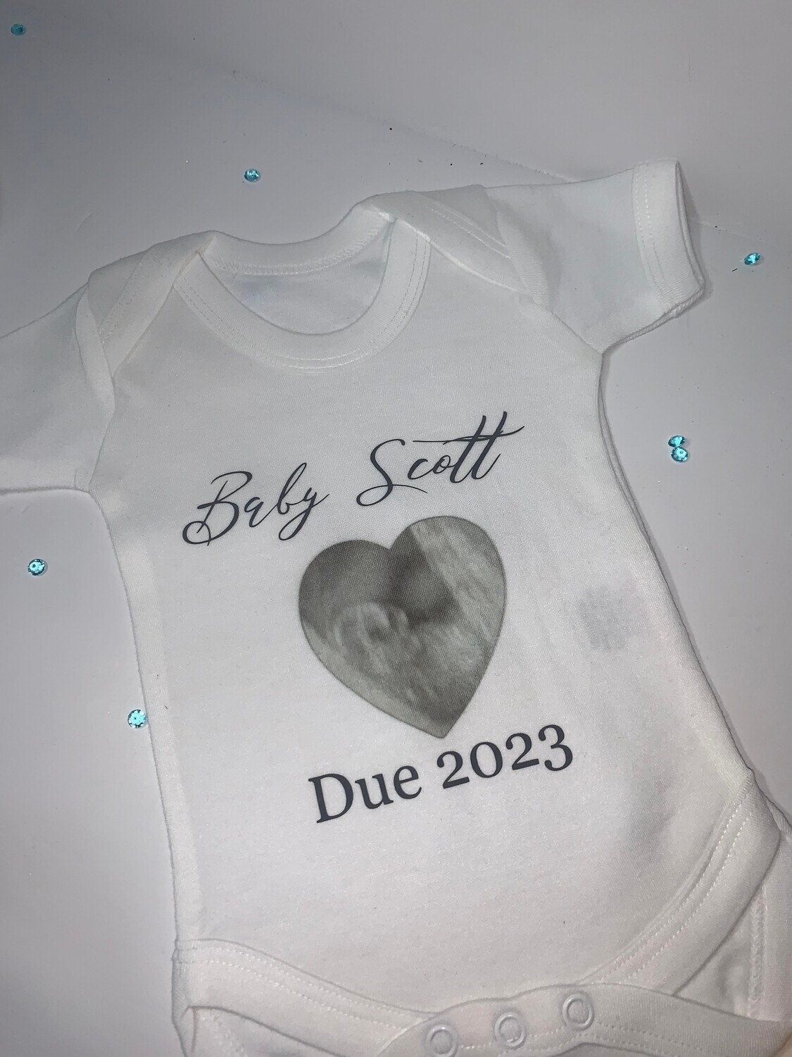 Personalised Baby Vest: Add Your Scan Picture