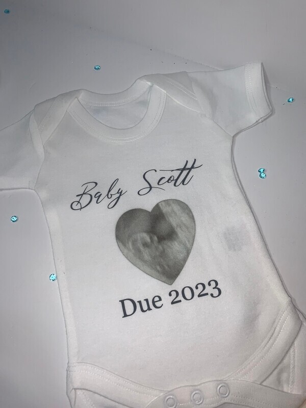 Personalised Baby Vest: Add Your Scan Picture