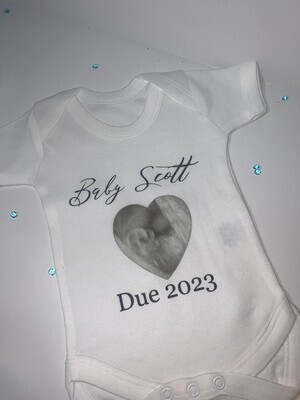 Personalised Baby Vest: Add Your Scan Picture