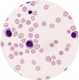 Cell Enrichment