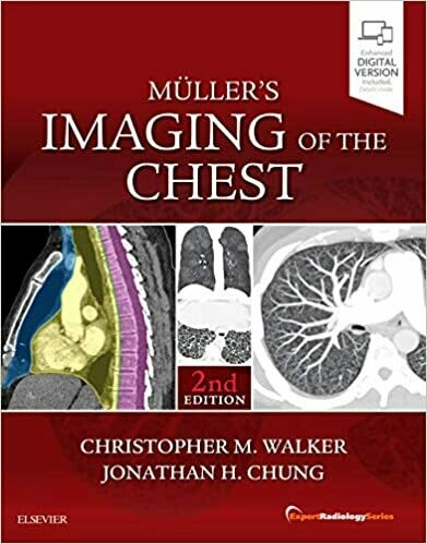 Muller&#39;s Imaging of the Chest 2nd Edition