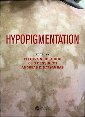 Hypopigmentation 1st Edition