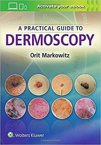 A Practical Guide to Dermoscopy Illustrated Edition