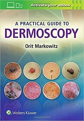 A Practical Guide to Dermoscopy Illustrated Edition